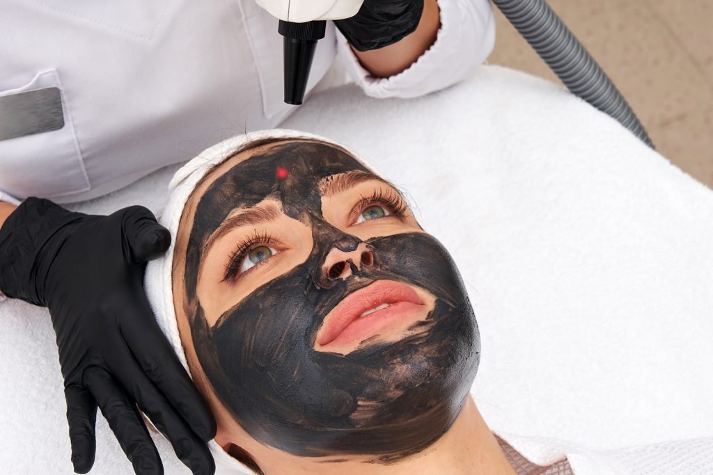 6829b62054277b39dc438fce_hollywood-carbon-peel-2-1024x683-theuns