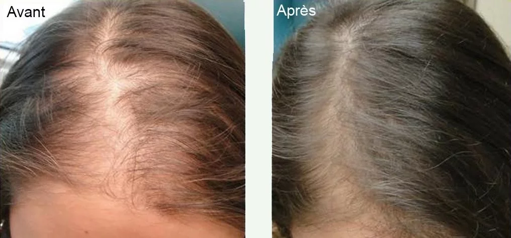 cheveux-av-ap-femme__1016
