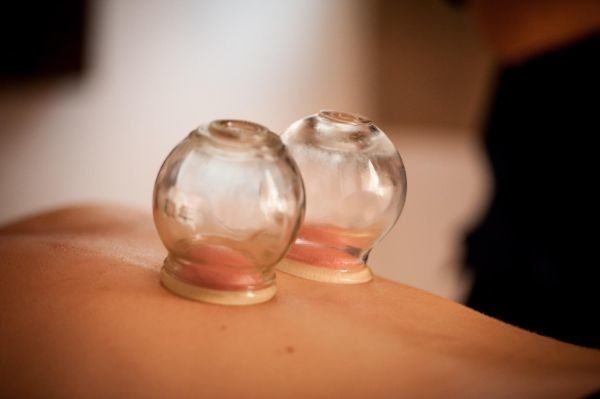 cupping-ventouses-TPV-02@2x